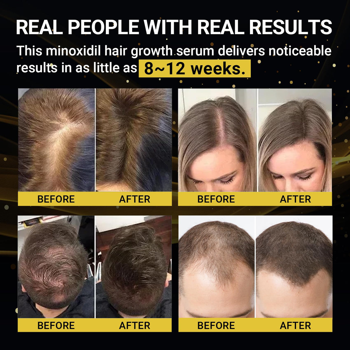 GIOTTO 5% Minoxidil Hair growth Serum for Men and Women - Infused with Biotin