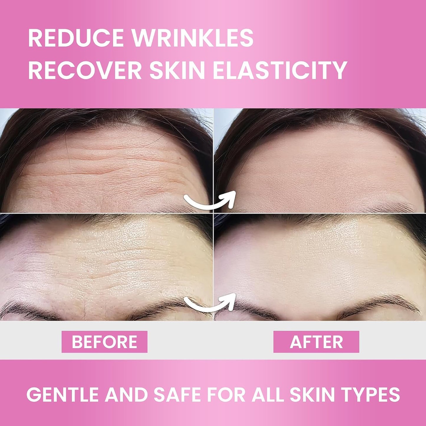 VIORY Forehead Wrinkle Patches Smoothing Overnight - Anti Wrinkle Patches | For Face And Forehead Fine Lines & Frown Lines, With Aloe, Collagen, Vitamin E, Hyaluronic Acid, 12 Pcs