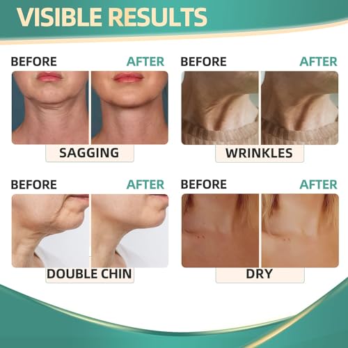 Neck Cream for Tightening Firming: Instant Face Lift Cream - Wrinkle Cream for Women