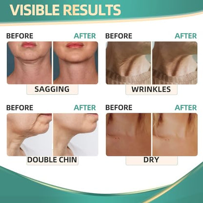 Neck Cream for Tightening Firming: Instant Face Lift Cream - Wrinkle Cream for Women