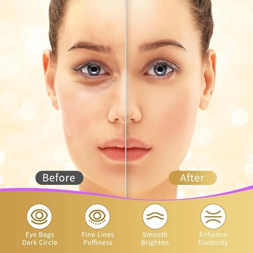 Under Eye Patches, 40 Pairs Eye Mask for Dark Circles, Puffy Eyes, Undereye Bags
