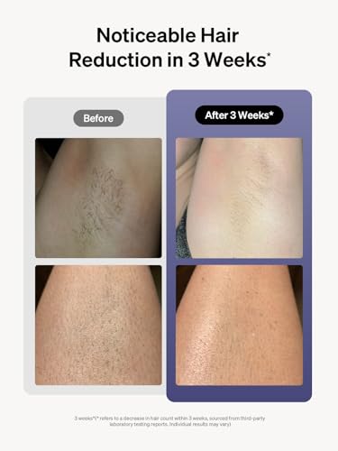 Ulike Laser Hair Removal for Women and Men, Air 3 IPL Hair Removal with Sapphire Ice-Cooling System