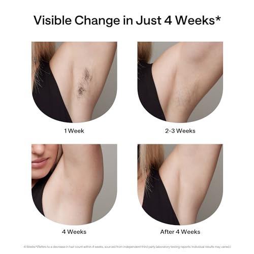 Ulike Laser Hair Removal for Women and Men, Air+ IPL Hair Removal Device with Ice
