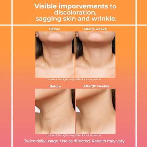Neck Firming Cream for Women: Neck Cream - Neck Tightening Cream - Neck Creams