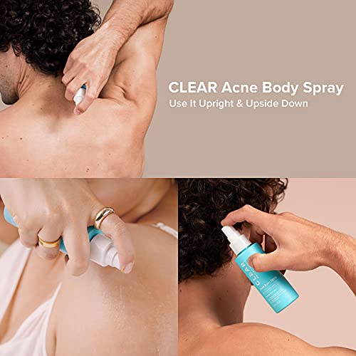 Paula's Choice CLEAR Back & Body Exfoliating Acne Spray, 2% BHA (Salicylic Acid)