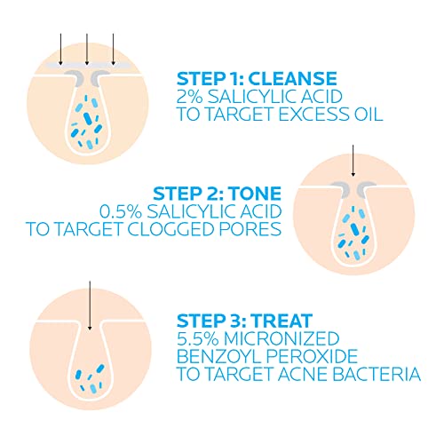 La Roche-Posay Effaclar Dermatological 3 Step Acne Treatment System