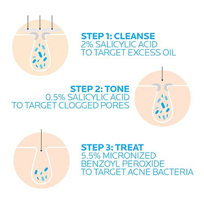 La Roche-Posay Effaclar Dermatological 3 Step Acne Treatment System