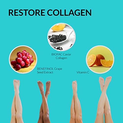 UpNourish Anti Cellulite Supplements - Varicose Veins Support, Restless Leg Relief