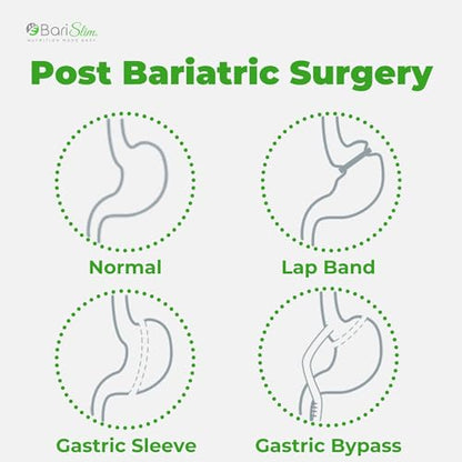 BariSlim Iron Plus Capsules - Formulated for Patients After Weight Loss Surgery Including