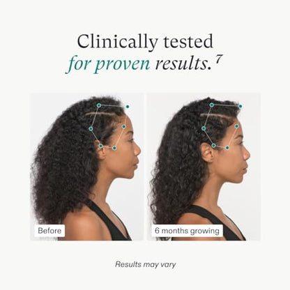 Nutrafol Women's Vegan Hair Growth Supplements, Plant-based and Gluten-free