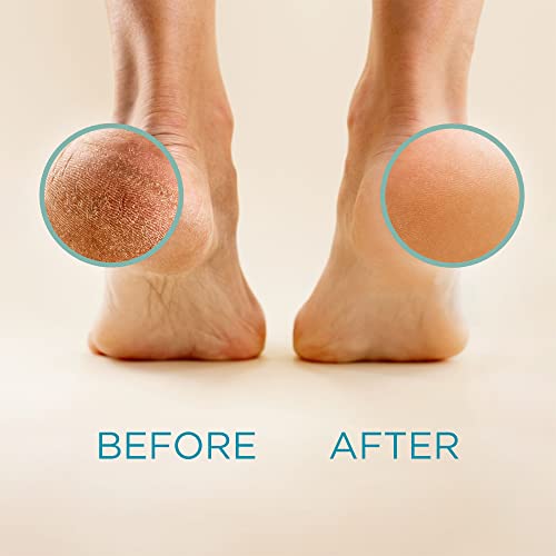 Lee Beauty Professional Callus Remover for Feet - 8 Oz, Original, Powerful