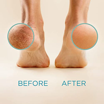 Lee Beauty Professional Callus Remover for Feet - 8 Oz, Original, Powerful