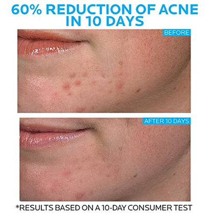 La Roche-Posay Effaclar Duo Dual Action Acne Spot Treatment Cream with Benzoyl Peroxid