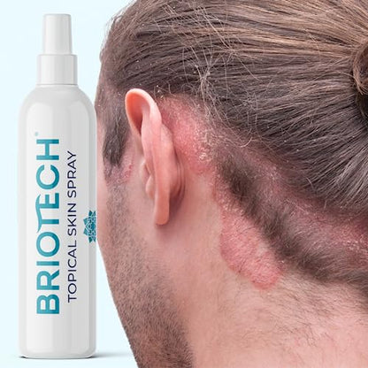 BRIOTECH Pure Hypochlorous Acid Spray, Multi Purpose Topical Body & Facial Mist, Eyelid