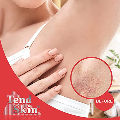 Tend Skin The Skin Care Solution For Unsightly Razor Bumps, Ingrown Hair And Razor