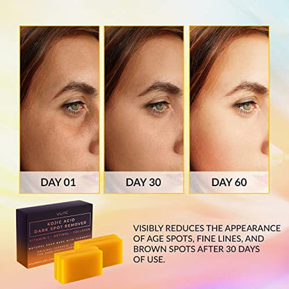 VALITIC Kojic Acid Dark Spot Remover Soap Bars with Vitamin C, Retinol, Collagen