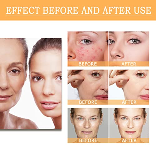 Glycolic Acid 7% Toner,Glycolic Sour 7% Toning,Exfoliate,and Rejuvenate Your Skin
