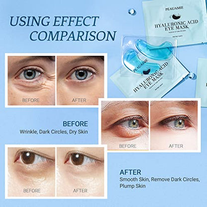 PEAUAMIE Under Eye Patchs (30 Pairs) Hyaluronic Acid Eye Mask for Dark Circles