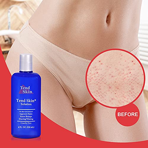 Tend Skin Womens AfterShave/Post Waxing Solution for Ingrown Hair, Razor Bumps
