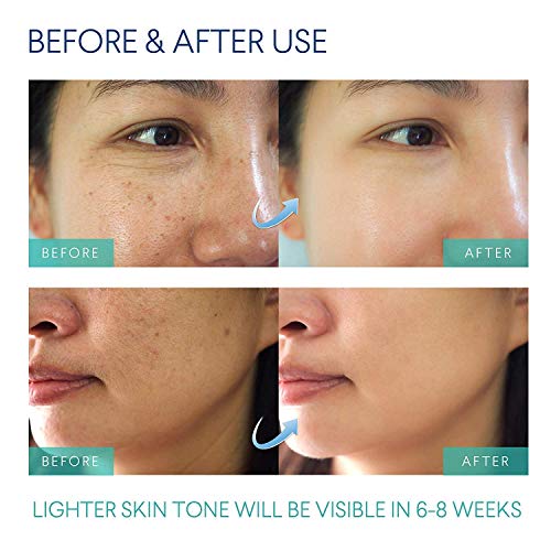 Razor Bumps Treatment for Women and Men, Ingrown Hair Treatment, Razor Bump Treatment
