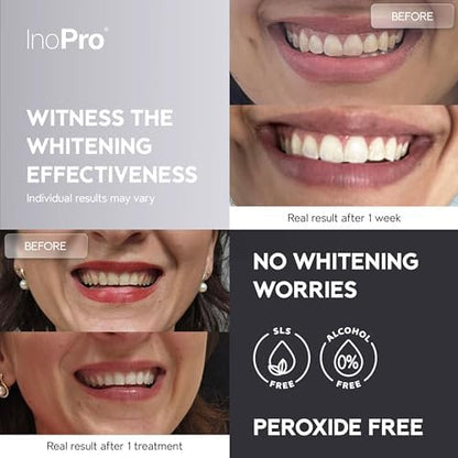 2-in-1 Teeth Whitening Strips Kit 35 Treatments - Advanced Teeth Whitening Kit (14 Treatments) + Innovative Teeth Whitening Kit (21 Treatments)