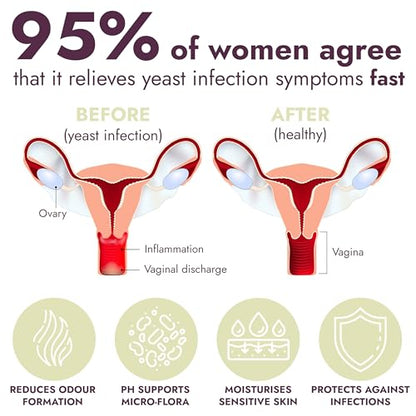 Yeast Infection Treatment for Women | 7 Pre-Filled Applicators w/ Borax | Antifungal Ointment