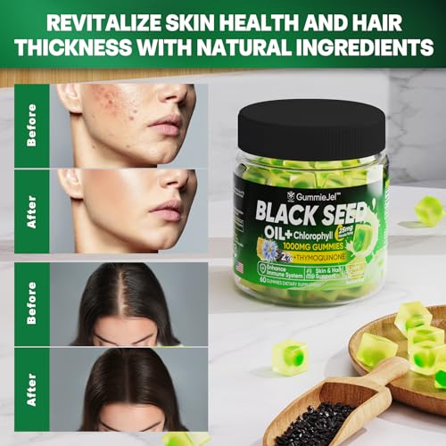 Sugar Free Black Seed Oil Filled Gummies & Chlorophyll, with Hydrolyzed Collagen