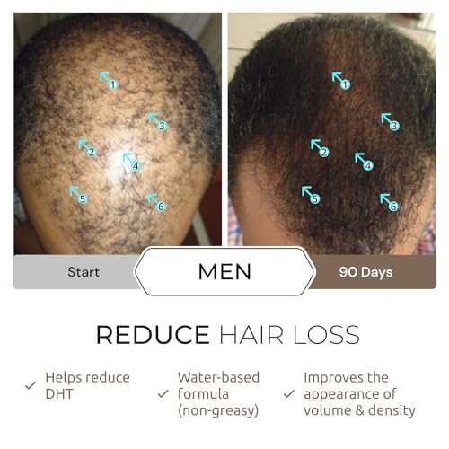 DS Laboratories Spectral.DNC-N Hair Density Serum - Hair Serum to Support Hair Growth