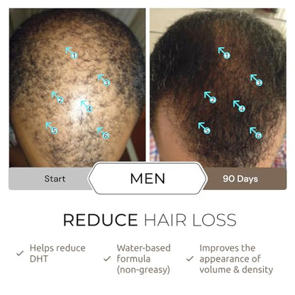 DS Laboratories Spectral.DNC-N Hair Density Serum - Hair Serum to Support Hair Growth