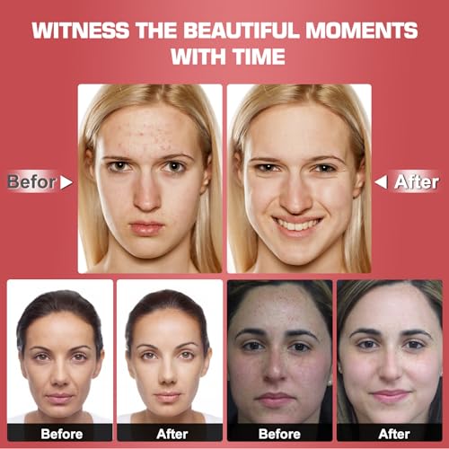 Red Light Therapy M-Ask Red Light Facial M-Ask Red Light Therapy for Face 7-1 Colors Light for Face Home Use
