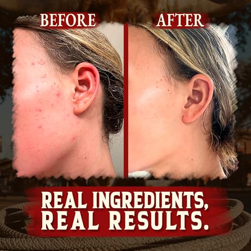 Beef Tallow for Cooking (14 oz) + Organic Beef Tallow for Skin - 4 OZ (Vanilla)