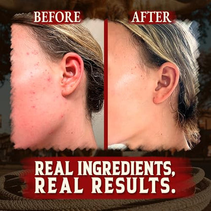 Beef Tallow for Cooking (14 oz) + Organic Beef Tallow for Skin - 4 OZ (Vanilla)