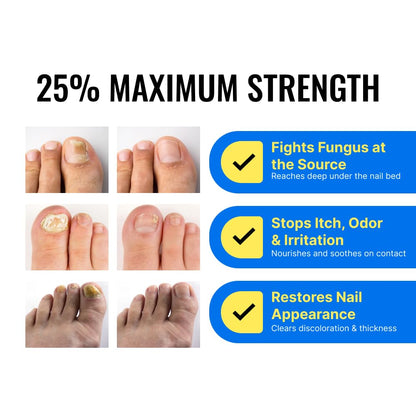 Approved Science Fungix Extra Strength - Undecylenic Acid and Tea Tree Oil - Serum for Fingernail and Toenail Care - Infused with Essential Oils - Healthy Nail Appearance - Easy to Apply - Pack of 1