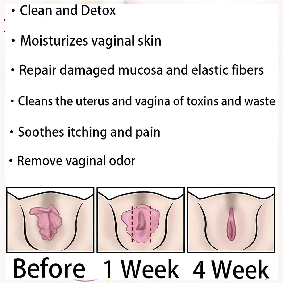 EXGYAN AnnieCare Instant Anti-Itch Detox Slimming Products, Annie Care Capsulas