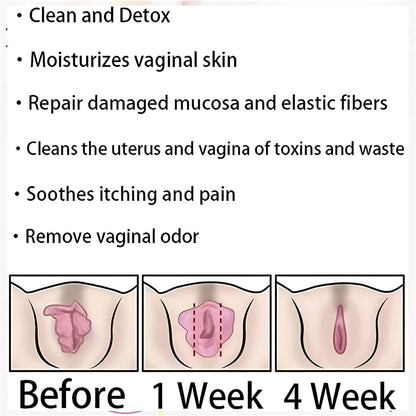 EXGYAN AnnieCare Instant Anti-Itch Detox Slimming Products, Annie Care Capsulas
