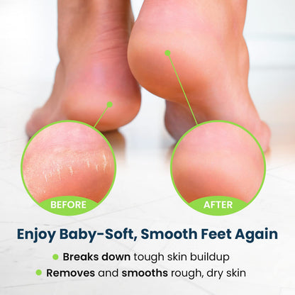 Toenail Fungus Treatment Extra Strength - Advance nail fungus treatment for fingernails