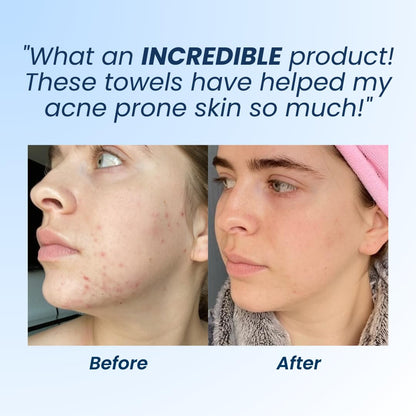 Clean Skin Club Clean Towels XL, 100% USDA Biobased Dermatologist Appr