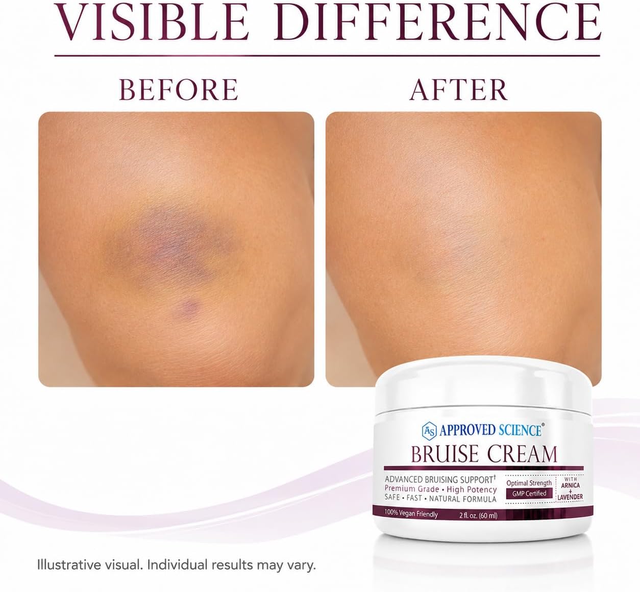 Approved Science Bruise Cream - Arnica and Lavender - Soothe and Fade Bruises - 6 Fl. Oz - 3 Pack - Vegan