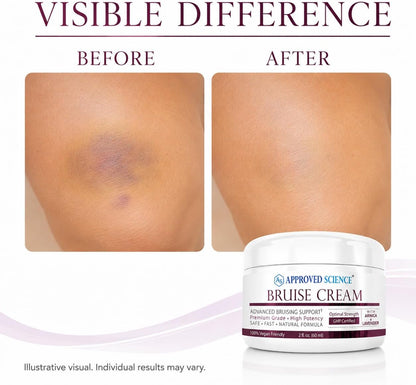 Approved Science Bruise Cream - Arnica and Lavender - Soothe and Fade Bruises - 6 Fl. Oz - 3 Pack - Vegan