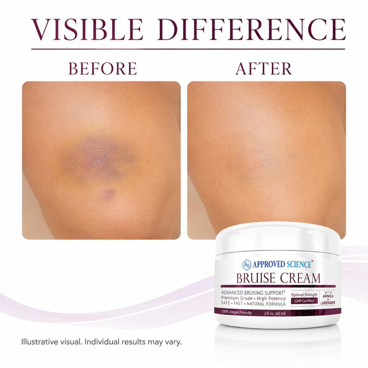 Approved Science Bruise Cream - Arnica and Lavender - Soothe and Fade Bruises - 6 Fl. Oz - 3 Pack - Vegan
