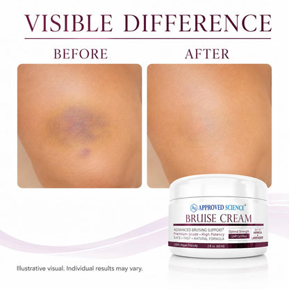 Approved Science Bruise Cream - Arnica and Lavender - Soothe and Fade Bruises - 6 Fl. Oz - 3 Pack - Vegan