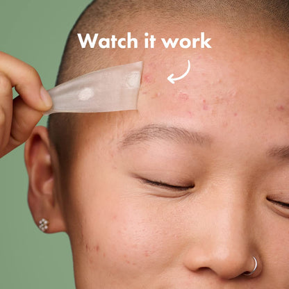 Mighty Patch™ Surface patch from Hero Cosmetics - Hydrocolloid Spot Patch for Body