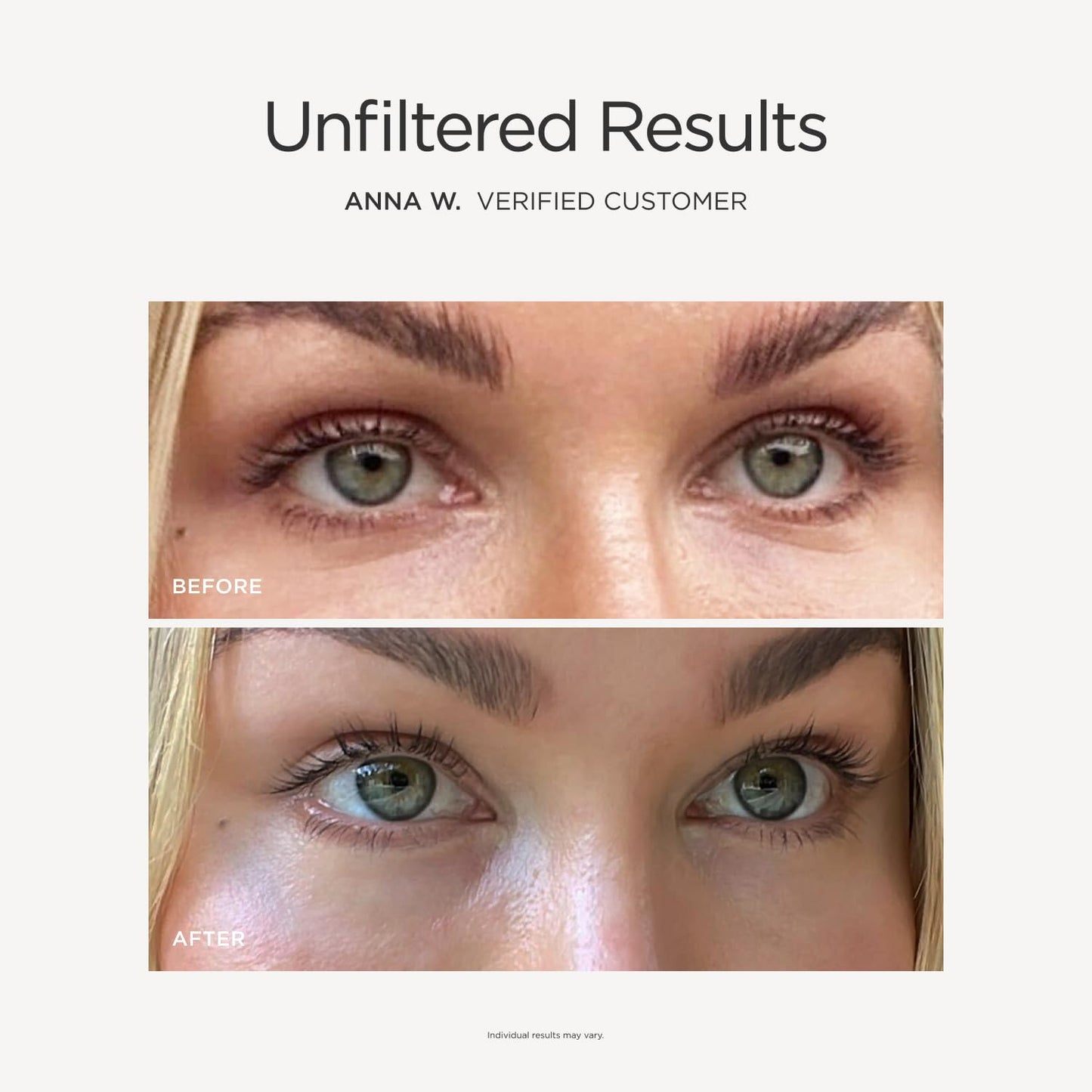 JSHealth Illuminating Peptide Eye Serum. Triple Action Eye-Q Complex with Caffeine, Niacinamide, Eyeseryl Peptide. Firms, De-Puffs, Brightens. Vegan (0.5 fl oz)