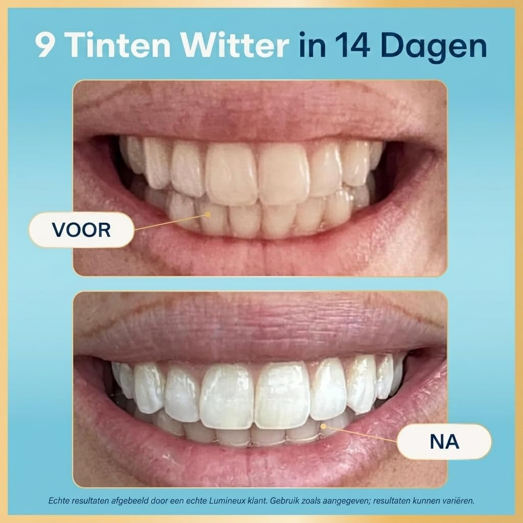 Lumineux Teeth Whitening Strips 9 Treatments – Peroxide Free - Enamel Safe for Whiter Teeth - Whitening Without The Sensitivity - Dentist Formulated and Certified Non-Toxic - Sensitivity Free