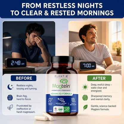 Magnesium L-Threonate Capsules – Brain & Sleep Support – 144mg Elemental Magnesium per Serving – High Absorption Cognitive & Memory Support – 120 Capsules