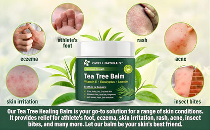 Owell Naturals Tea Tree Antifungal Balm – Extra Strength for Athlete’s Foot, Jock Itch, Ringworm & Skin Fungus – Soothing for Itchy, Dry, Cracked Skin, Feet & Body, 2 oz