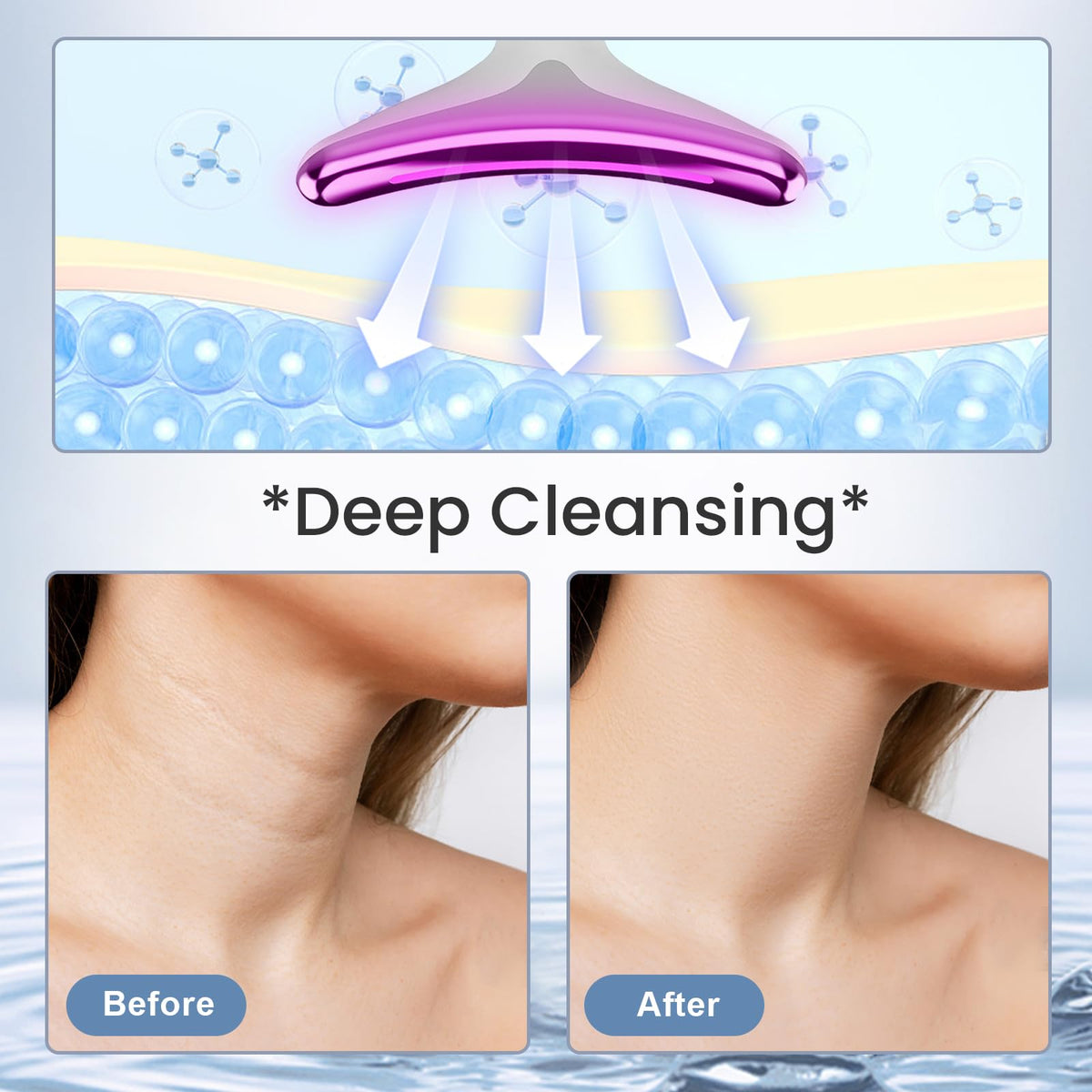 YAYIET Vibration Face and Neck Massager - Triple-Action Wrinkle Remover for Skin Care