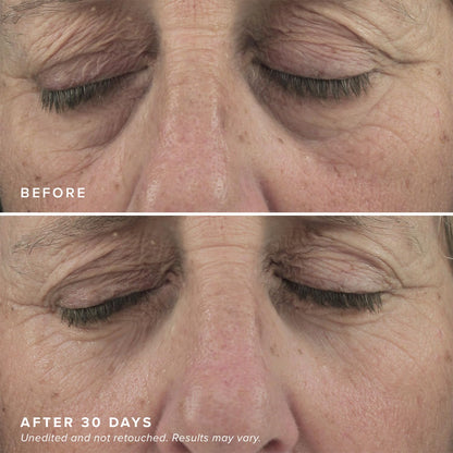 DRMTLGY Brightening Eye Masks - Caffeine Eye Masks for Dark Circles and Puffiness