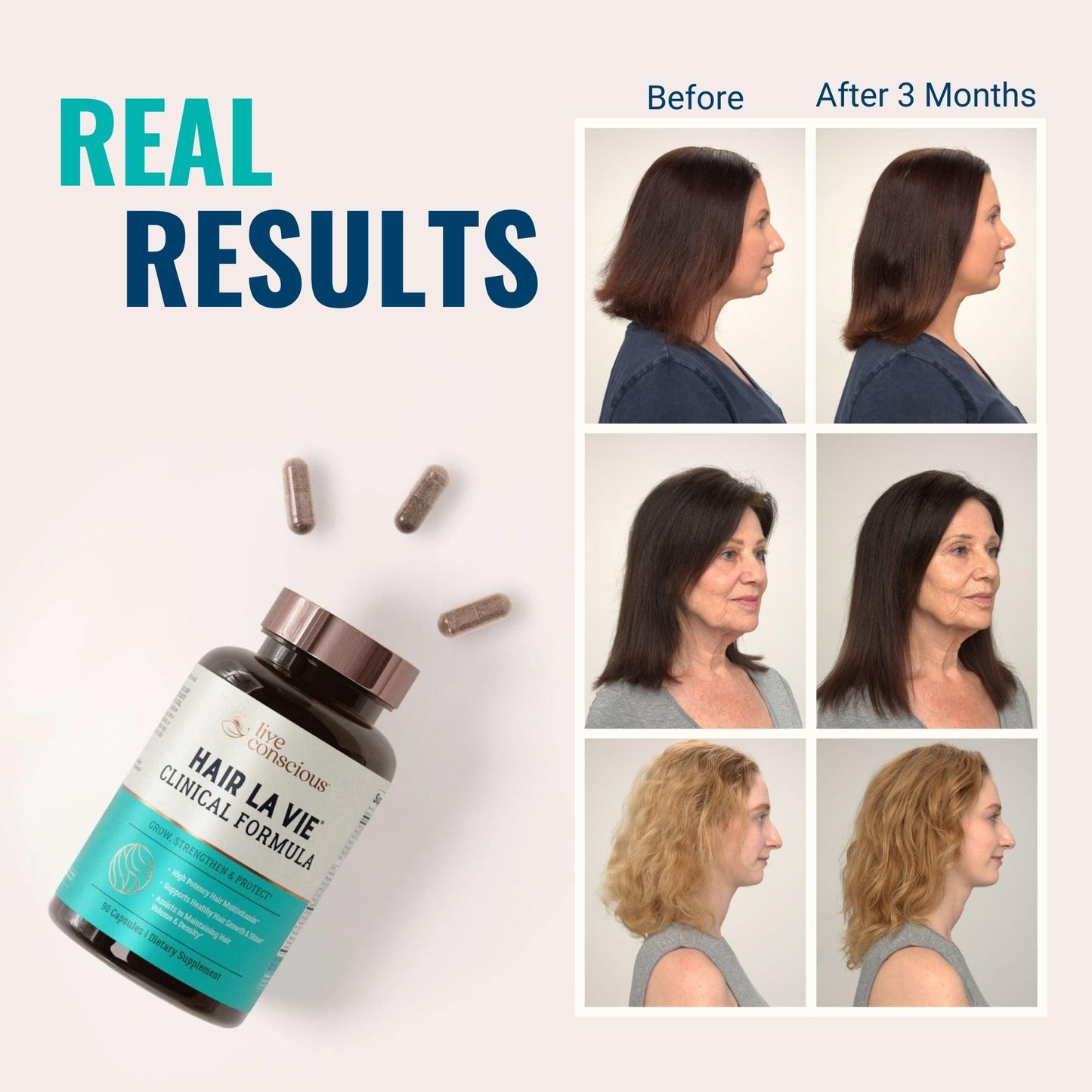 Hair La Vie Live Conscious Clinical Formula Hair Growth Vitamins for Women and Men w/Biotin, Collagen & Saw Palmetto (Pack of 1)