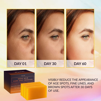 Valitic Unisex Dark Spot Corrector Bar, 100g - Exfoliating, SLS and Paraben-Free Turmeric